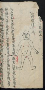 Chinese Medical Manuscripts 小兒各種驚圖 (Slg. Unschuld 8439)